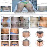 Best Quality New Coming 50 / 60Hz 2016 Cryolipolysie Machine Cellulite Reduction thumbnail-5