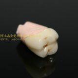 Dental Crown 3M Lava Zirconia, Dental Teeth, Dental Prosthesis, Laboratoire Dentaire, Dentallabor, Laboratorio Dental, Dental Laboratory, Shenzhen LJ Dental Lab China thumbnail-2
