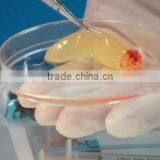 PRP Kits With Syringe thumbnail-3