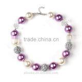 Cartoon Horse Pendant Kids Chunky Bubblegum Fashion Necklace thumbnail-3