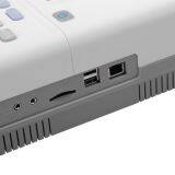 Hotsale Digital Hospital Electrocardiograph 12 Channel ECG Machine thumbnail-5