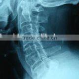 Medical Manufacturer Made in China Supplier for Hospital Dry Film Japan Film thumbnail-3