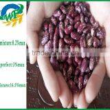 Chinese Purple Speckled Kidney Beans for Sale thumbnail-3