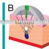 8MHz 2016 Body Shape Fastest Weight Loss Chest Shaping Slimming Liposonix HIFU Portable Ultrashape Cavitation Machine High Frequency Beauty Machine thumbnail-2