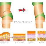 Best Quality Cellulite Removal Kuma Shape Body Slimming Machine for Sale thumbnail-6