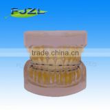 orthodontic teeth model(Transparent model , normal tooth, invisible brackets),dental orthodontic models