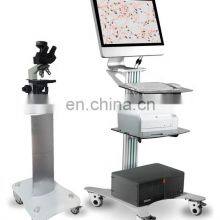 High Accuracy Sperm Counting Computer Assisted Sperm Quality Analyzer Sperm Analyzer Trolley thumbnail-1