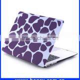 Top Level Cheapest Hard Cover Case for Macbook Air 11 thumbnail-3