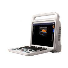 C20 Color Ultrasound Machine, Color Doppler thumbnail-1