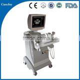Hospital Equipment Ultrasonic/Ultrasound Scanner,Trolley Ultrasound thumbnail-1