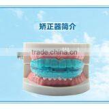 TOP Blue Tooth Orthodontic Alignment Trainer thumbnail-4