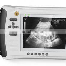 HC-A018V Veterinary Ultrasound Machine Ultrasound Handheld Device Medical Ultrasound Machine thumbnail-5