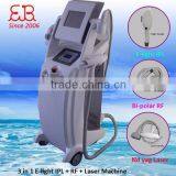 2015 Ipl Laser Tattoo Removal Machine Price Laser Tattoo Naevus Of Ota Removal Removal Machine E-light Ipl Rf Nd Yag Laser Multifunction Machine Vascular Tumours Treatment thumbnail-1