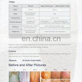 Профессиональное портативное устройство для обработки кожи УФВ УФ-лампой, фототерапевтическое оборудование 308 Эксимерный лазер 308 нм, лазерная машина для лечения псориаза и витилиго thumbnail-6