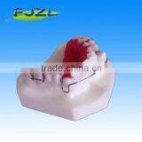Orthodontics Treatment Model thumbnail-1