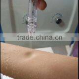 Four in One Ozone Output + Diamond Dermabrasion + PDT Oxygen Jetpeel for Skin Rejuvenation thumbnail-6