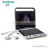 Medical Hospital 4d Portable Color Ultrasound Sonoscape s9