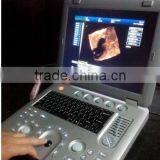 Portable Ultrasound Machine CU18A Made by Latest Color Ultrasoun Technology thumbnail-6