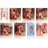 TD4A-WS Benchtop Low-speed PRP &PRF & CGF Centrifuge Machine thumbnail-5