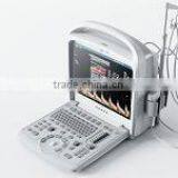 Hot Sale Color Doppler Ultrasound Machine for Sale thumbnail-2