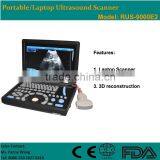 CE Approved Laptop Portable Ultrasound Scanner With 3.5Mhz Multi-frequency Convex Probe RUS-9000E2 thumbnail-1
