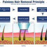 High Quality Most Popular Products for Salon SHR+E-light(IPL+RF )Machine With 2 Handles thumbnail-5