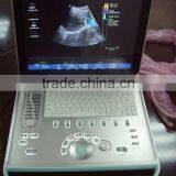 New Type Laptop Color Doppler Ultrasound for Human With Laptop thumbnail-1