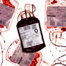 Blood Bag Labels Primary /Secondary Blood Transfer Bags Labels thumbnail-3