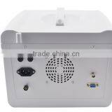 Hot Seller Full Digital Portable Ultrasound Scanner RUS-6000D With Convex Microconvex Probe thumbnail-4
