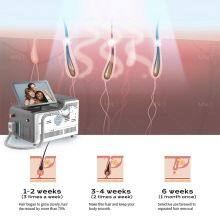 Hospital Use Laser Hair Removal Machine Price thumbnail-5