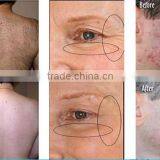 Elight Ipl Shr Hair Removal Beauty Equipment With Manufacturing Price on Biggest Discount thumbnail-4