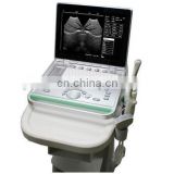 China made portable doppler ultrasound scanner machine Laptop ultrasound