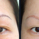 Portable Q Switch ND YAG Laser /Skin thumbnail-4