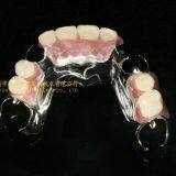 Dental Co-Cr Partial Denture,Titanium Framework Denture, Dental Dentures, Laboratoire Dentaire, Dentallabor, Laboratorio Dental, Dental Laboratory, Shenzhen LJ Dental Lab China thumbnail-5