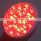 2016 New Head Detachable Photon RF Skin Tightening System thumbnail-3