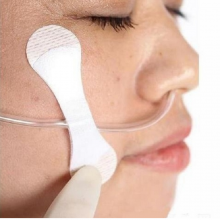 Epidural Catheter Fixation thumbnail-5