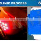 Best Cellulite Fat Removal Machine With Multi Languages System thumbnail-5