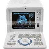 Hot Seller Full Digital Portable Ultrasound Scanner RUS-6000D With Convex Microconvex Probe thumbnail-2
