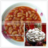 Canned White Kidney Beans in Can Made in China thumbnail-1