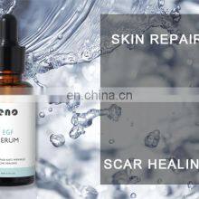 Professional Anti Wrinkle Skin Repairing Skin Care Private Label EGF Repair Serum thumbnail-4