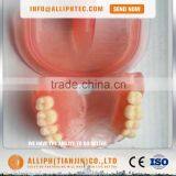 Aluminium Tube for Flexible Valplast Material Empty Dental Cartridges thumbnail-6