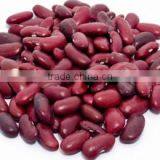 Quality Kidney Beans,Red and Black Kidney Beans,white Kidney Beans thumbnail-3