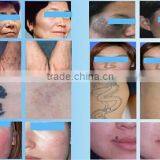 1500mj Electronic Products Machinery Laser Tattoo Removal 1000W Q Switch Nd Yag Laser Medical Machines thumbnail-6