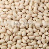 2012 Crop White Kidney Bean, Japanese White thumbnail-1