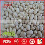 High Quality White Kidney Beans for Sale at Cheap Price thumbnail-2