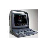 Siemens Acuson Cypress Plus Portable Ultrasound Machine thumbnail-1