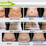 Cavitation Liposuction and Tighten Skin Device Fat Freezing Liposuction Machine CM 01 thumbnail-6