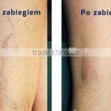 Professional Vascular Vein Stopper 980nm Varicose Veins Removal Diode Laser Machine thumbnail-5