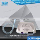 2016 New980 Laser Spider Vein Removal 20W High Power / Beauty Equipment 980 Laser NEW!!!/ 980nm Laser Vascular Removal Machine thumbnail-5