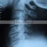 Fuji Medical Films Medical X Ray Film thermal dry film made in china